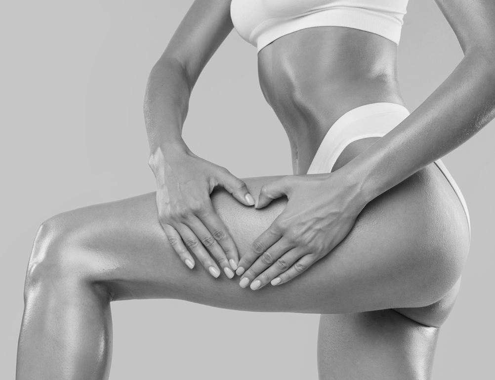 ThighLift ThighLift